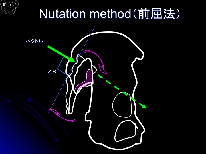 SIN法 参考資料