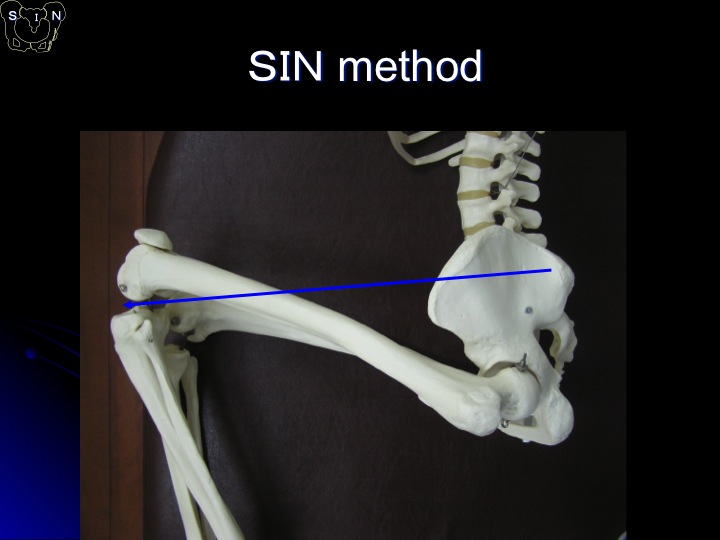 SIN法 参考資料